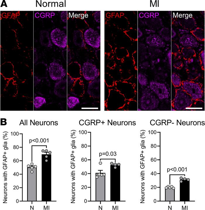 Nonselective augmentation of satellite glial cell activation following M...