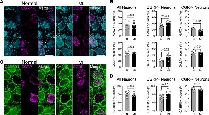 Upregulation of inhibitory GABAergic neurotransmission specifically in C...