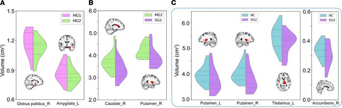 Subcortical nuclei with significant volumetric differences between group...