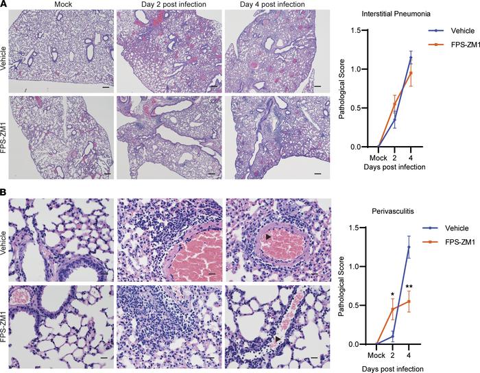 FPS-ZM1 treatment reduces lung perivascular inflammation.
K18-hACE2 mice...