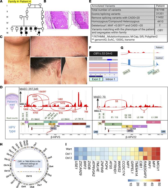 Family pedigree, clinical features, cutaneous histopathology, HPV typing...