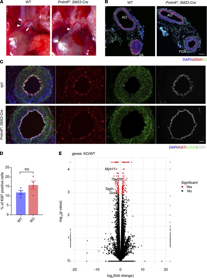Smooth muscle–specific disruption of Prdm6 in mice alters transcript lev...