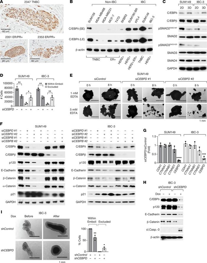C/EBPδ is expressed in IBC emboli in vivo and IBC cell lines in vitro an...