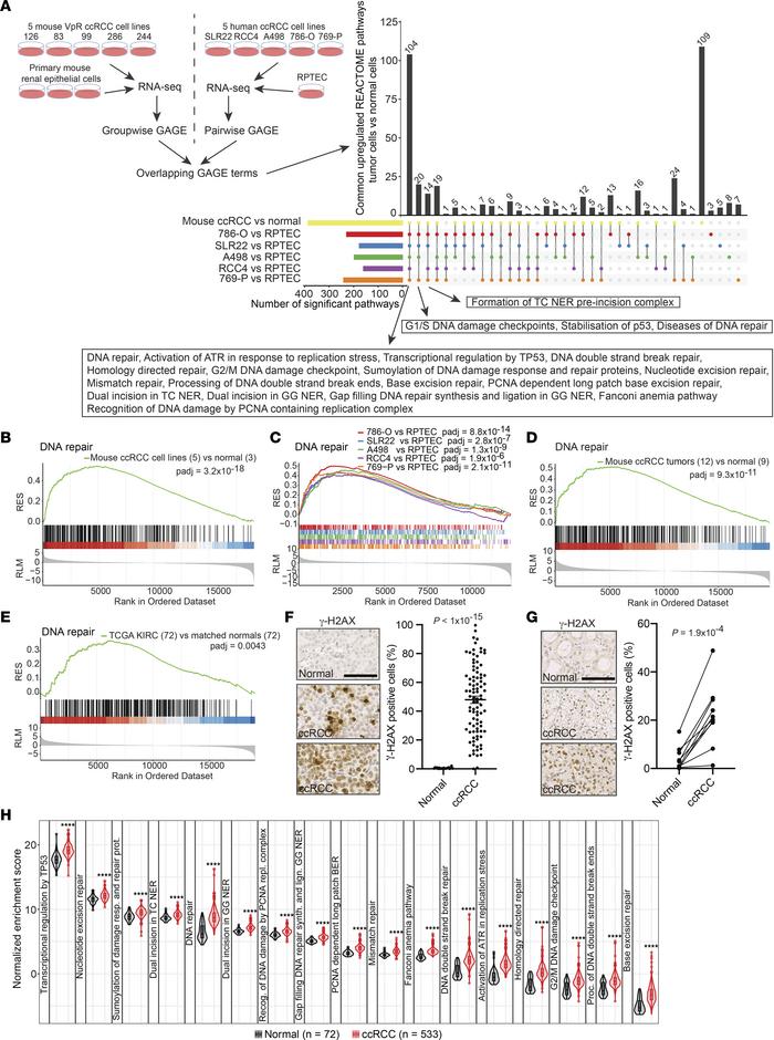 Endogenous DNA damage in ccRCC.
(A) Experimental overview and summary of...