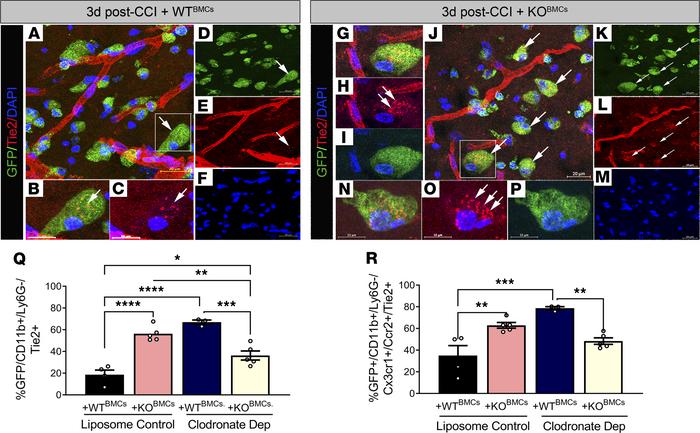 Peripheral Epha4 deficiency and monocyte depletion increase Tie2 recepto...