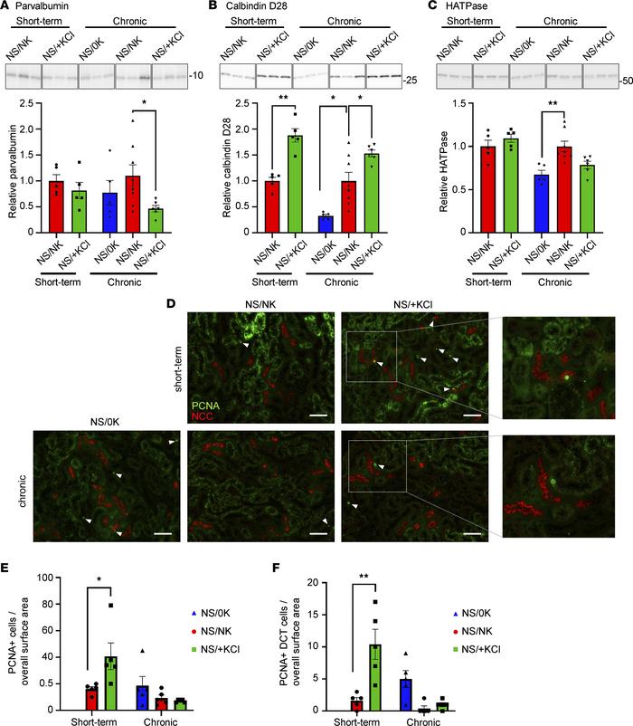 High KCl feeding promotes kidney remodeling.
(A and B) After chronic NS/...