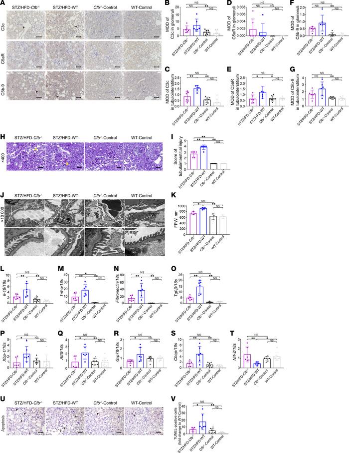 Kidney damage is alleviated in Cfb-deficient diabetic mice.
Immunohistoc...