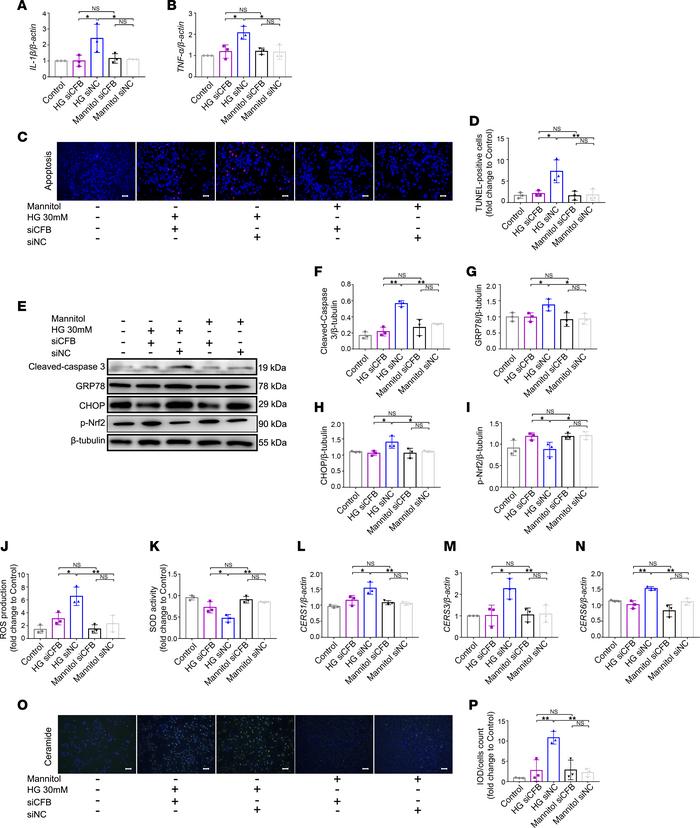 
CFB knockdown alleviates PTEC damage and ceramide biosynthesis under HG...