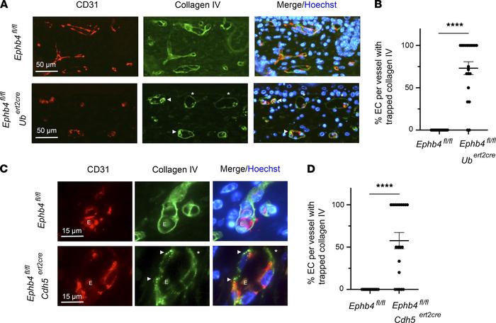 Collagen IV accumulation in ECs of induced EPHB4-deficient embryos.
TM w...