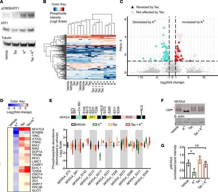 The Cn/NFATC4 pathway is activated upon K+ stimulation in NCI-H295R cell...