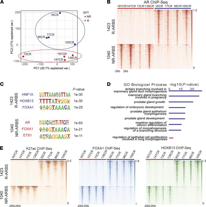 AR ChIP-Seq of pretreatment PDX tumors reveals distinct AR cistromes in ...