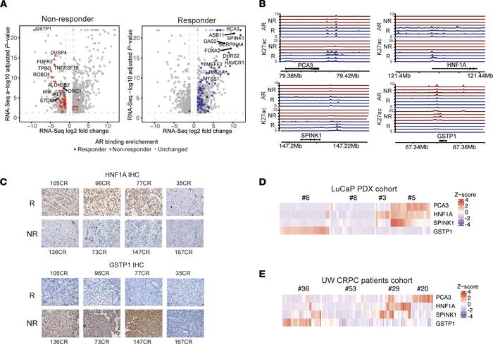 Identification of potential biomarkers of SPT responsiveness by integrat...