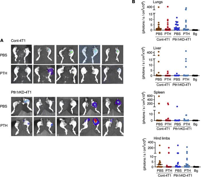 Treatment with intermittent PTH does not reduce skeletal metastasis in o...
