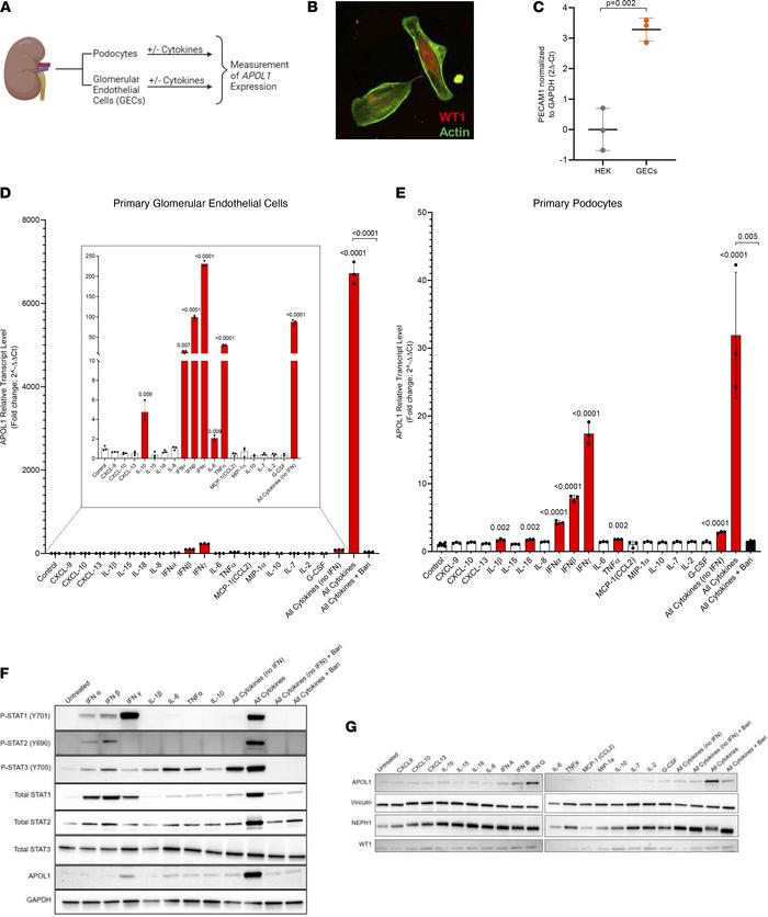 Cytokine storm synergistically induces APOL1 expression in primary human...
