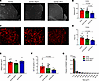 The caspase-8/RIPK3 axis promotes Aβ amyloidosis in 5xFAD mice.