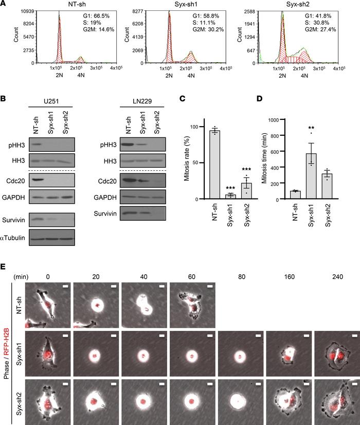 Syx is required for GBM cell cycle progression and mitosis.
(A) Represen...