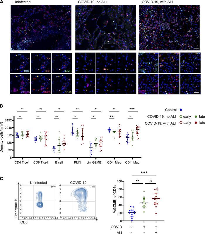 Patterns of immune cell infiltration associated with lung tissue patholo...