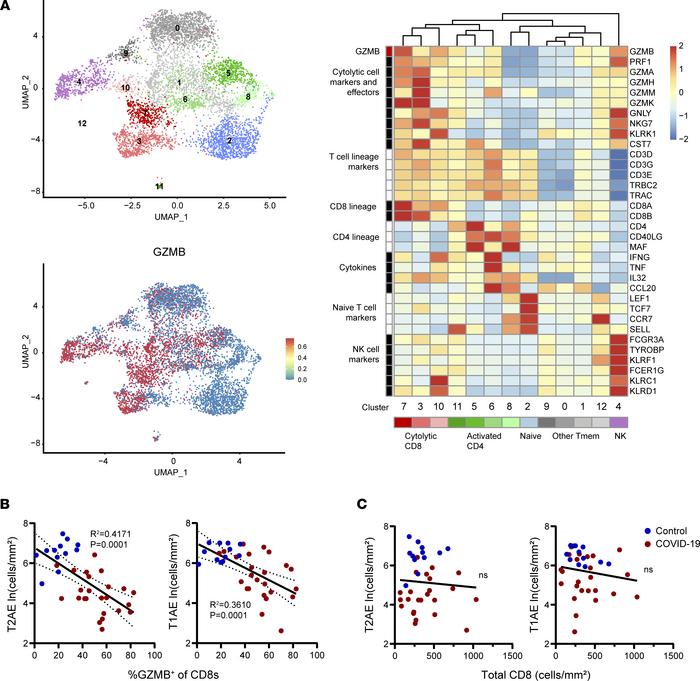 Correlation of lung T cell cytotoxicity with alveolar epithelial cell lo...