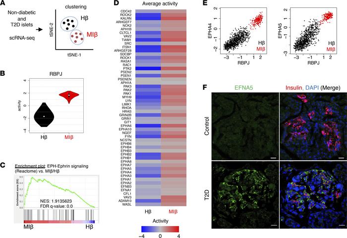 Increased Notch and Ephrin signaling in metabolically inflexible human β...