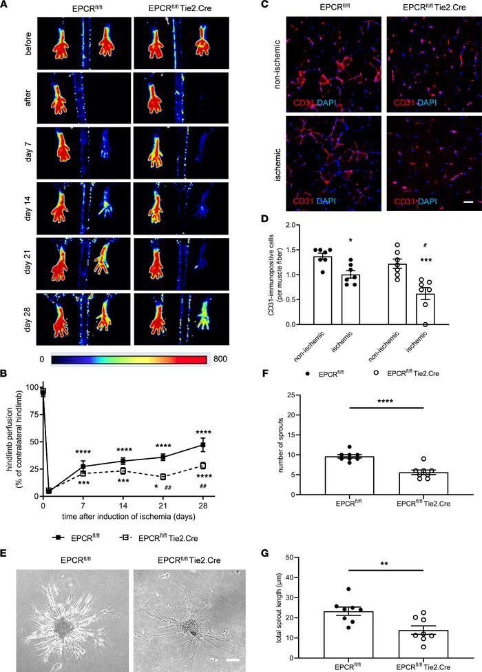 Reperfusion and new vessel formation following ischemia in mice lacking ...