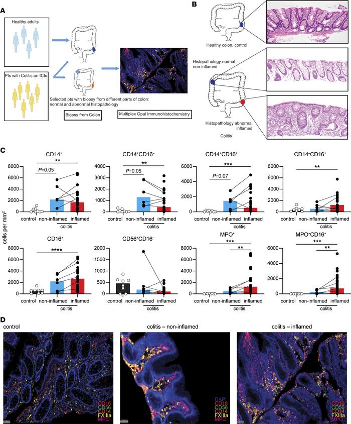 Myeloid cell subsets are altered at both histologically normal and disea...