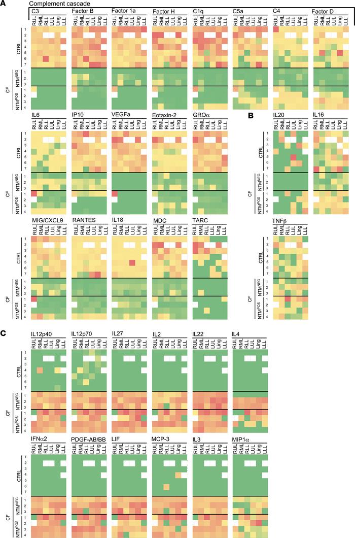 Complement pathway members are largely absent from the airways of PwCF, ...