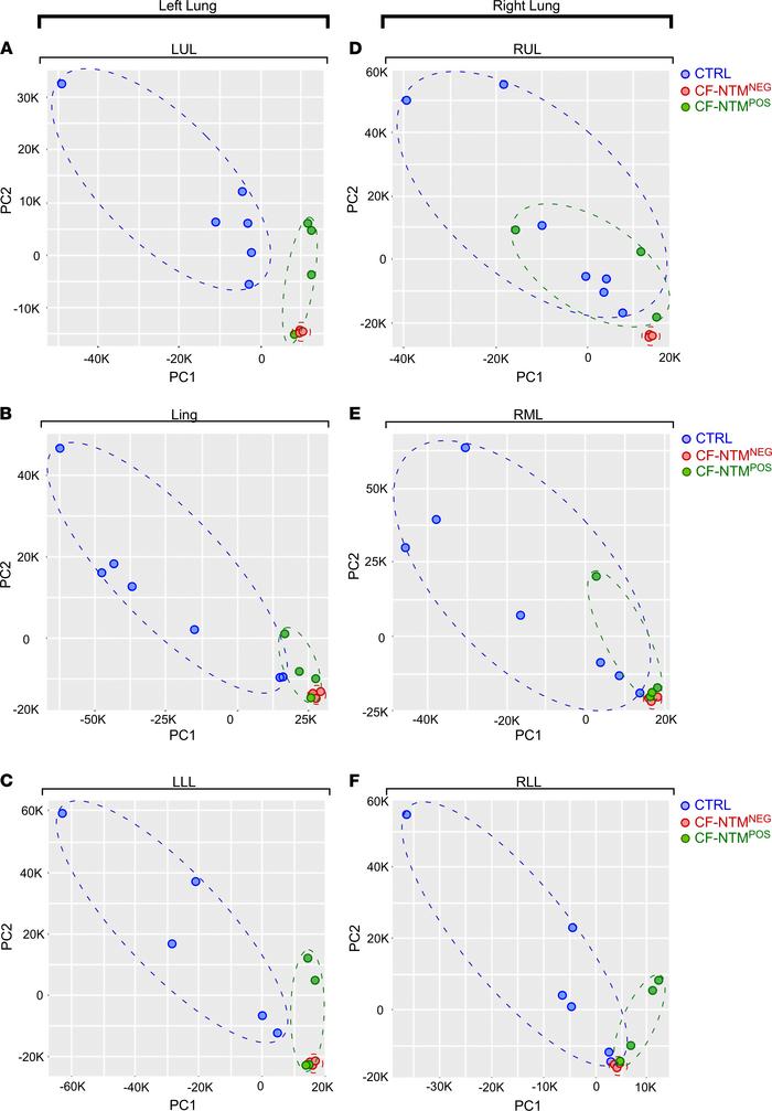 Cytokine and complement biomarker differences between individuals who ar...