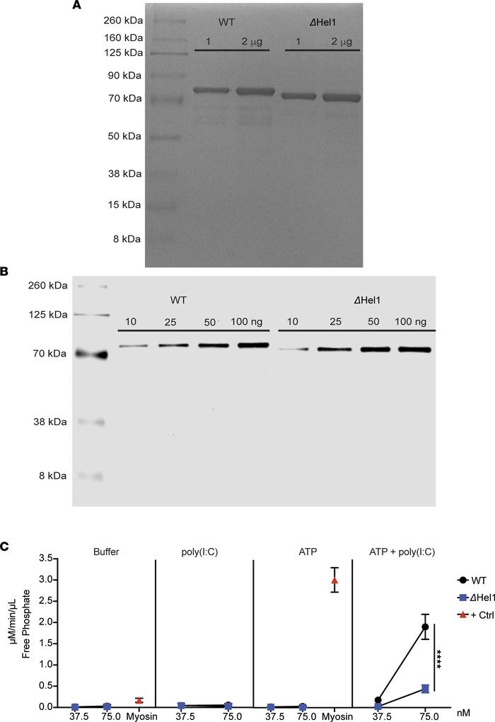
Ifih1ΔHel1 mutation reduces MDA5-mediated ATP hydrolysis.
Representativ...