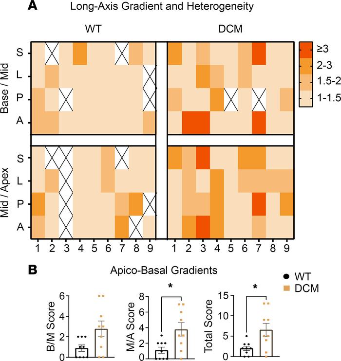 DCM model shows increased heterogeneity of sympathetic innervation gradi...