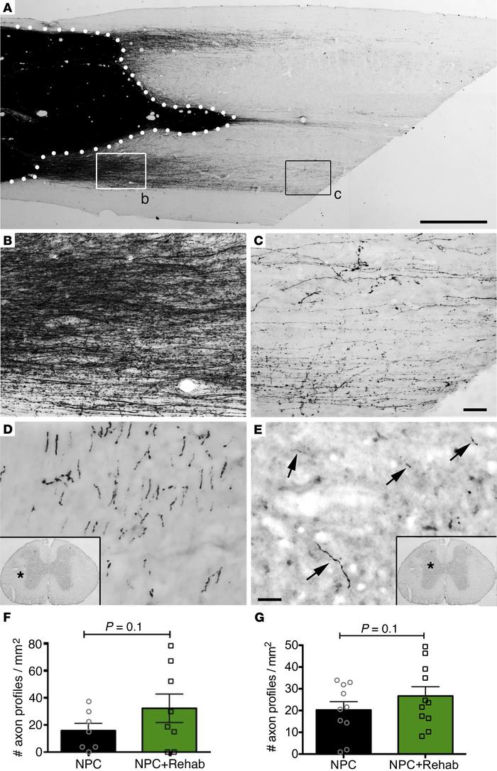 Axonal outgrowth from neural progenitor cell grafts.
(A) GFP light-level...