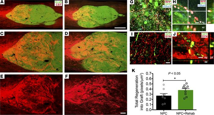 Corticospinal regeneration into neural progenitor cell graft.
(A and B) ...