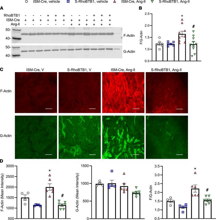 Actin polymerization.
(A and B) F-actin and G-actin were separated by ul...
