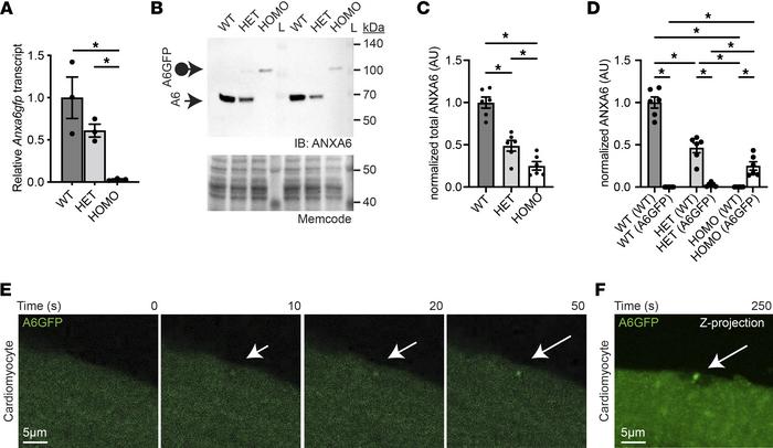 Genomically encoded annexin A6GFP localizes at the site of cardiomyocyte...
