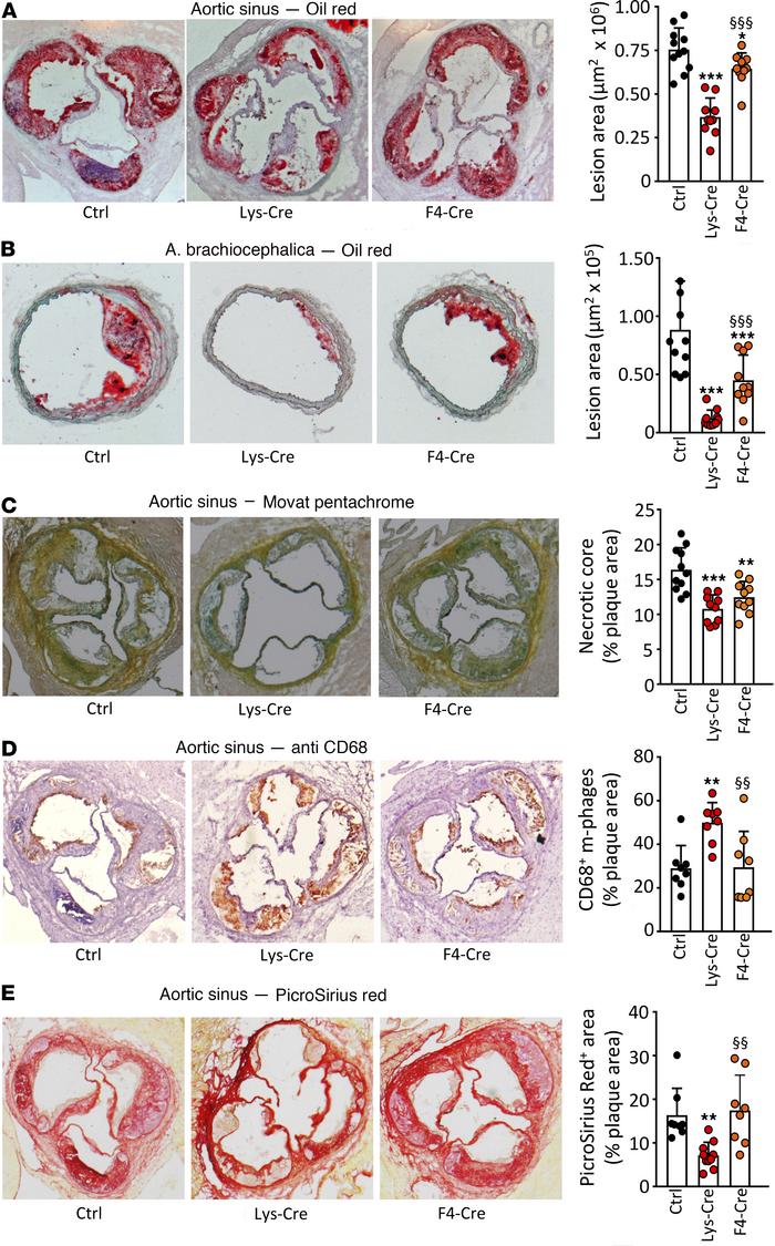 S1P1 overexpression in macrophages and monocytes retards atherosclerotic...