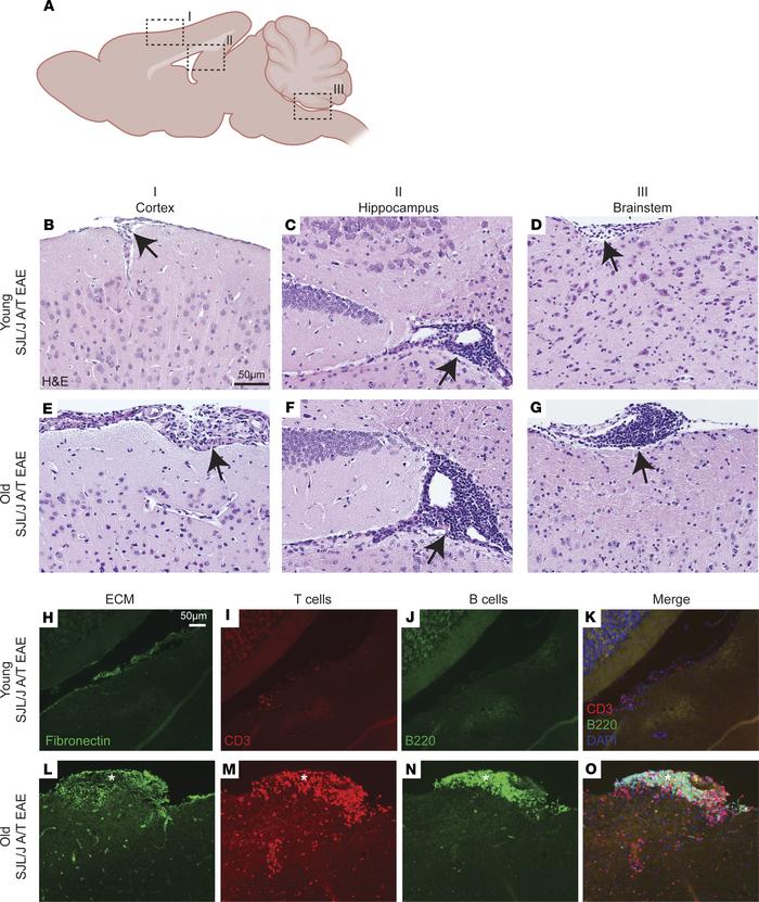 Aging induces accumulation of lymphocytes in leptomeninges adjacent to s...