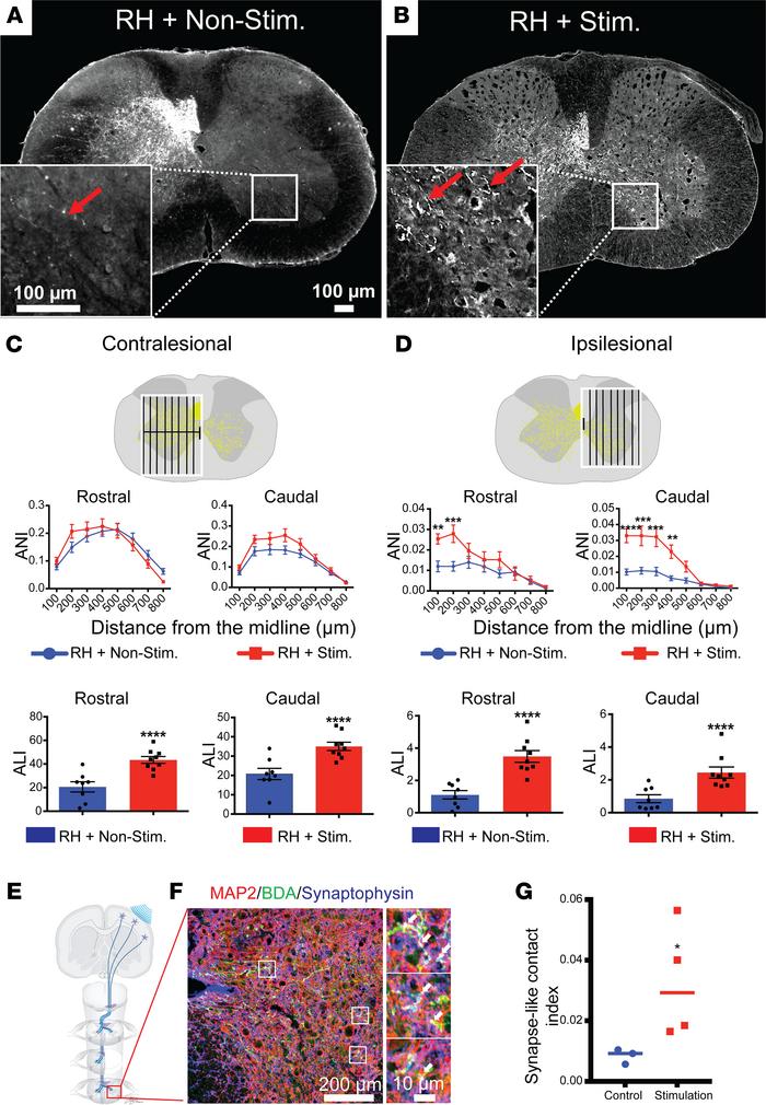 Transcranial optogenetic stimulation promotes intact contralesional CST ...