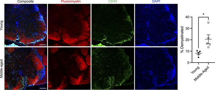 Spinal cord demyelination and inflammatory infiltration are exacerbated ...