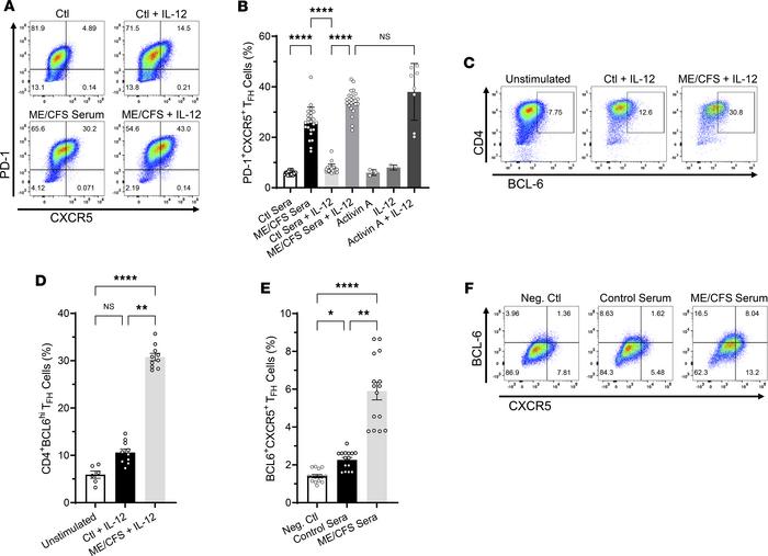 ME/CFS sera drive TFH cell differentiation of human naive CD4+ T cells i...