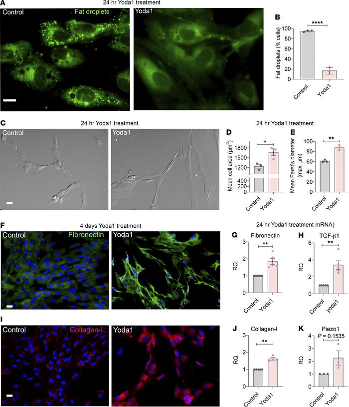 Piezo1 agonist, Yoda1, induces stellate cell activation and fibrosis in ...