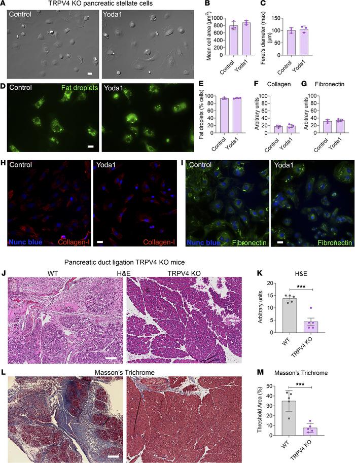 TRPV4-KO mice were protected from pancreatic duct ligation–induced fibro...