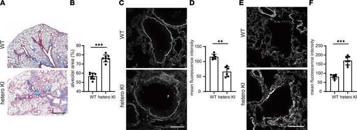 Extrarenal phenotypes of heterozygous V3684M KI mice at 72 weeks of age....
