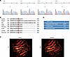 Identification of a potentially novel LAMA5 heterozygous variant for famili