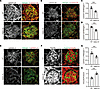 Protein expression of laminin α5, β2, γ1, and vinculin in the glomeruli in