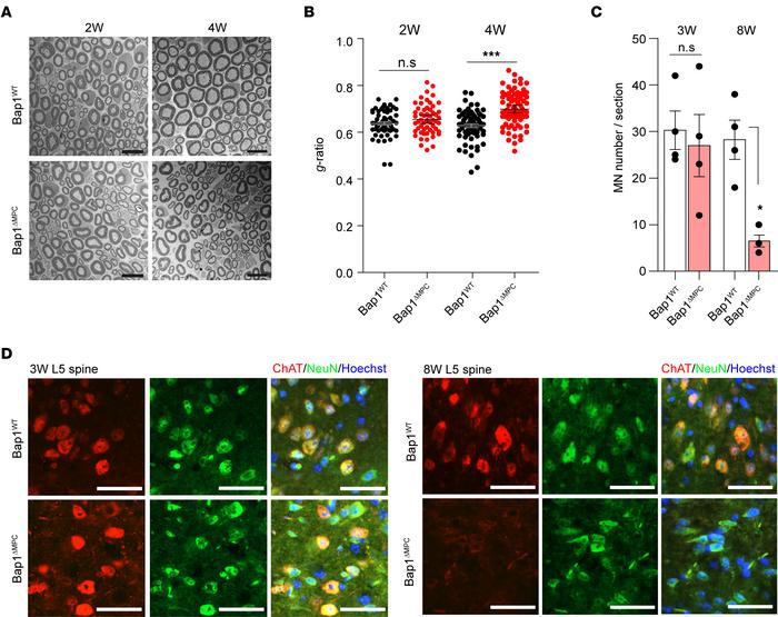 Loss of motor neurons in Bap1ΔMPC mice.
(A) Representative electron micr...