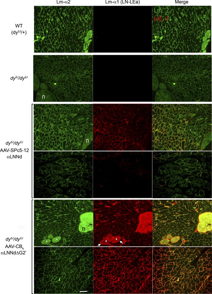 Laminin immunofluorescence in skeletal muscle.
Frozen sections from lowe...