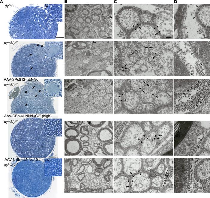 Sciatic nerve morphology.
(A) Representative methylene blue–stained semi...