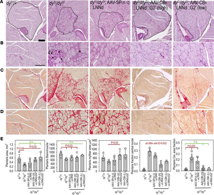 Histology of plantaris.
Hind limb muscles from 15-week-old mice, dy2J/+ ...