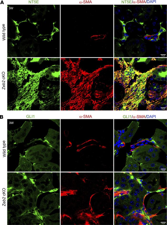 The abnormal myofibroblasts express fibroblast and pericyte markers NT5E...