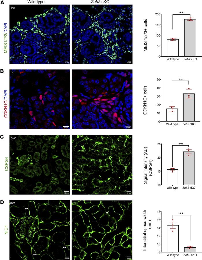 FOXD1+ stromal progenitors differentiate abnormally in Zeb2-cKO mice.
(A...