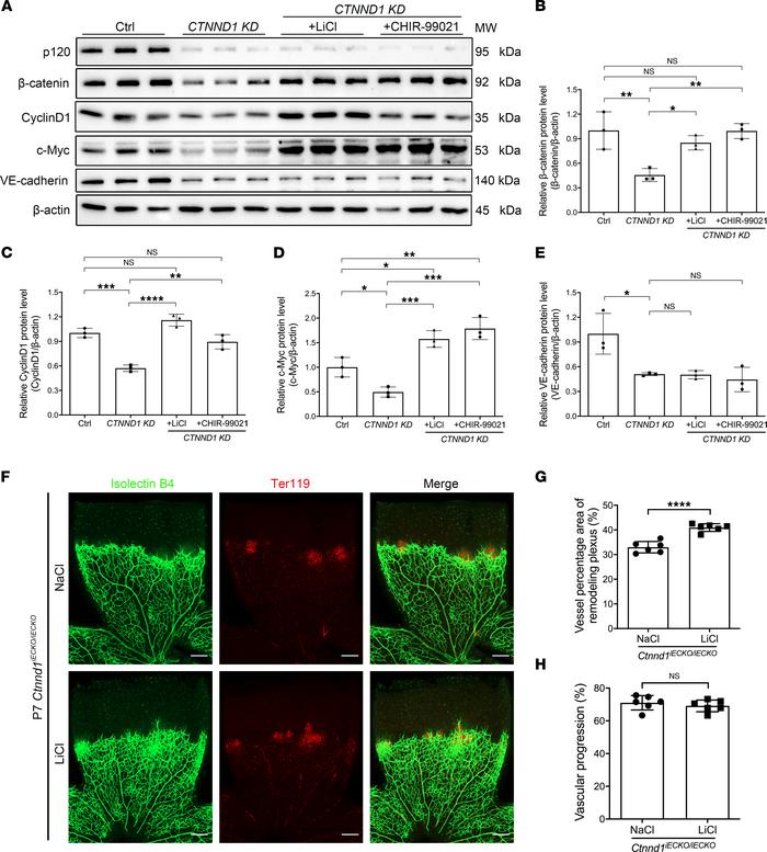 Treatment with LiCl or CHIR-99021 corrects the Wnt signaling activity in...